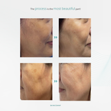 SKINCOMM UNICEL System / Science-based Skincare System / Transform your skin in 30 days
