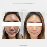 SKINCOMM UNICEL System / Science-based Skincare System / Transform your skin in 30 days