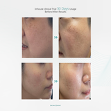 SKINCOMM UNICEL System / Science-based Skincare System / Transform your skin in 30 days