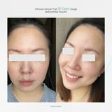 SKINCOMM UNICEL System / Science-based Skincare System / Transform your skin in 30 days