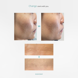 SKINCOMM UNICEL System / Science-based Skincare System / Transform your skin in 30 days
